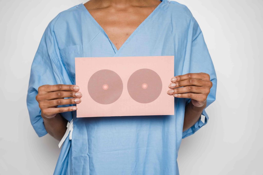 How to prevent sagging breasts post pregnancy
