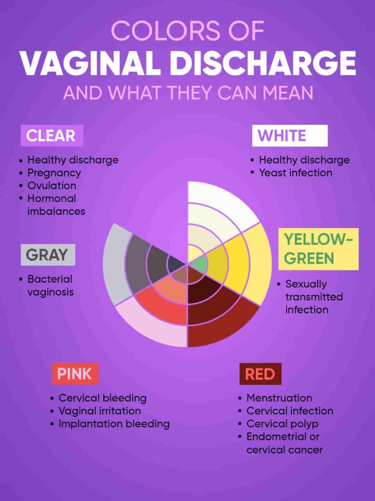 Vaginal Discharge Color Guide Causes And When To See A Off